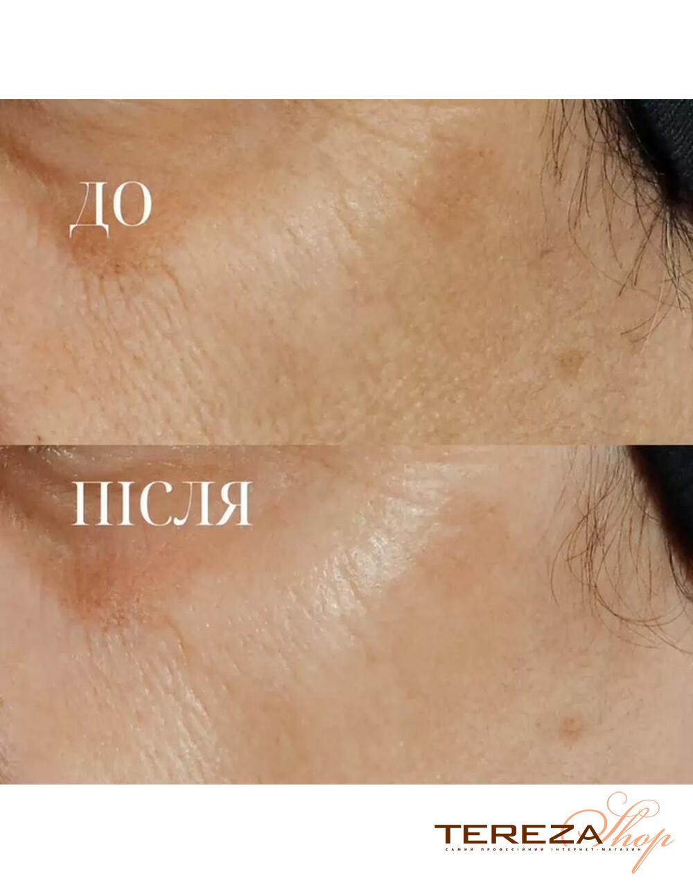 HIGH POTENCY TRIPLE RETINOL RENEWAL SERUM PERRICONE MD | Tereza Shop